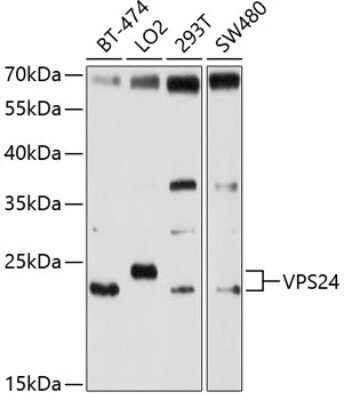 Western Blot: VPS24 Antibody [NBP2-93426] - Analysis of extracts of various cell lines, using VPS24 at 1:1000 dilution. Secondary antibody: HRP Goat Anti-Rabbit IgG (H+L) at 1:10000 dilution. Lysates/proteins: 25ug per lane. Blocking buffer: 3% nonfat dry milk in TBST. Detection: ECL Basic Kit . Exposure time: 20s.