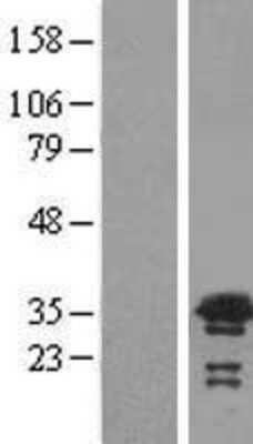 Western Blot VPS24 Overexpression Lysate