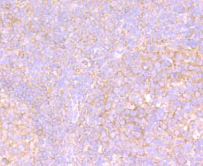 Immunohistochemistry-Paraffin: VPS26A Antibody (JB93-41) [NBP2-75709] - Analysis of paraffin-embedded human tonsil tissue using anti-VPS26 antibody. Counter stained with hematoxylin.