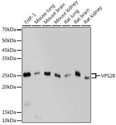 Western Blot: VPS28 Antibody (4F8M0) [NBP3-15703] - Western blot analysis of extracts of various cell lines, using VPS28 antibody (NBP3-15703) at 1:1000 dilution. Secondary antibody: HRP Goat Anti-Rabbit IgG (H+L) at 1:10000 dilution. Lysates/proteins: 25ug per lane. Blocking buffer: 3% nonfat dry milk in TBST. Detection: ECL Basic Kit. Exposure time: 10s.