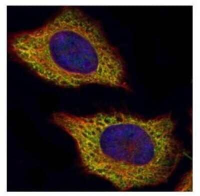 Immunocytochemistry/Immunofluorescence: VPS28 Antibody [NBP2-20870] - Confocal immunofluorescence analysis of methanol-fixed HeLa, using VPS28 antibody (Green) at 1:200 dilution. Alpha-tubulin filaments are labeled with Alpha-tubulin antibody (Red) at 1:2000.