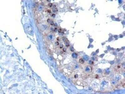 Immunohistochemistry-Paraffin: VPS28 Antibody [NB100-1399] - (10ug/ml) staining of paraffin embedded Human Testis. Microwaved antigen retrieval with Tris/EDTA buffer pH9, HRP-staining.