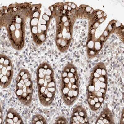 Immunohistochemistry-Paraffin: VPS28 Antibody [NBP1-85973] - Staining of human rectum shows strong cytoplasmic positivity in glandular cells.