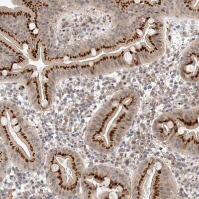 Immunohistochemistry-Paraffin: VPS28 Antibody [NBP1-85973] - Staining of human duodenum shows high expression.