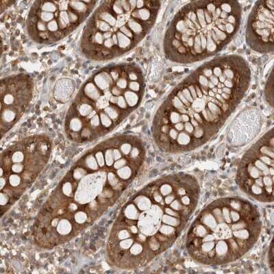 <b>Independent Antibodies Validation. </b>Immunohistochemistry-Paraffin: VPS28 Antibody [NBP1-85976] - Staining of human colon shows strong cytoplasmic positivity in glandular cells.