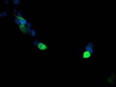 Immunocytochemistry/Immunofluorescence: VPS28 Antibody (OTI1A8) - Azide and BSA Free [NBP2-74854] - Analysis of COS7 cells transiently transfected by pCMV6-ENTRY VPS28.