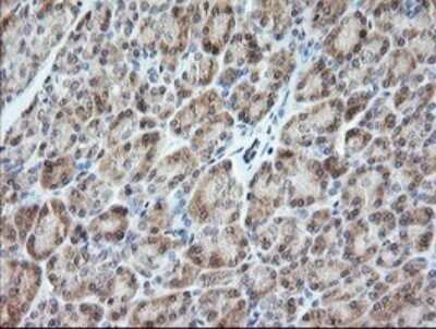 Immunohistochemistry: VPS28 Antibody (OTI1A8) - Azide and BSA Free [NBP2-74854] - Analysis of Human pancreas tissue. (Heat-induced epitope retrieval by 10mM citric buffer, pH6.0, 120C for 3min)