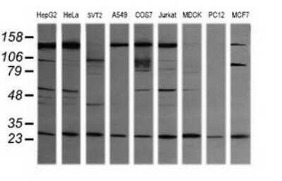 Western Blot: VPS28 Antibody (OTI1A8) - Azide and BSA Free [NBP2-74854] - Analysis of extracts (35ug) from 9 different cell line (HepG2: human; HeLa: human; SVT2: mouse; A549: human; COS7: monkey; Jurkat: human; MDCK: canine; PC12: rat; MCF7: human).