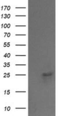 Western Blot: VPS28 Antibody (OTI1A8) - Azide and BSA Free [NBP2-74854] - Analysis of HEK293T cells were transfected with the pCMV6-ENTRY control (Left lane) or pCMV6-ENTRY VPS28.