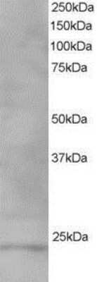 Western Blot: VPS28 Antibody [NB100-1399] - (1ug/ml) of Human Testis lysate (RIPA buffer, 35ug total protein per lane). Primary incubated for 1 hour. Detected by western blot using chemiluminescence.