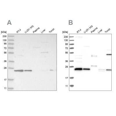 Western Blot: VPS28 Antibody [NBP1-85973] - Analysis using Anti-VPS28 antibody NBP1-85973 (A) shows similar pattern to independent antibody NBP1-85976 (B).