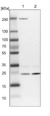 Western Blot: VPS28 Antibody [NBP1-85976] - Lane 1: NIH-3T3 cell lysate (Mouse embryonic fibroblast cells). Lane 2: NBT-II cell lysate (Rat Wistar bladder tumor cells).