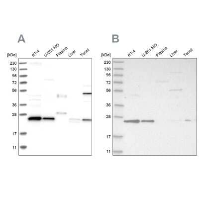 Western Blot: VPS28 Antibody [NBP1-85976] - Analysis using Anti-VPS28 antibody NBP1-85976 (A) shows similar pattern to independent antibody NBP1-85973 (B).