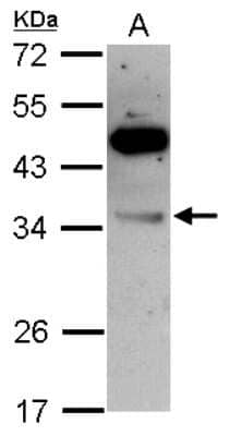 Western Blot: VPS28 Antibody [NBP2-20870] - Sample (30 ug of whole cell lysate) A: HCT116 12% SDS PAGE gel, diluted at 1:5000.