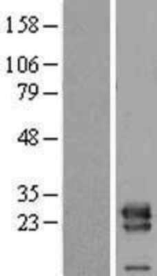 Western Blot: VPS28 Overexpression Lysate (Adult Normal) [NBL1-17742] Left-Empty vector transfected control cell lysate (HEK293 cell lysate); Right -Over-expression Lysate for VPS28.