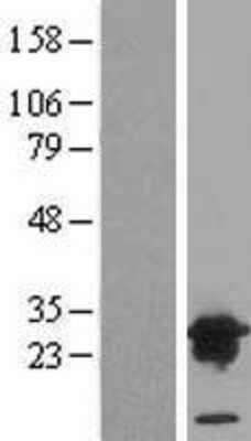 Western Blot: VPS28 Overexpression Lysate (Adult Normal) [NBL1-17743] Left-Empty vector transfected control cell lysate (HEK293 cell lysate); Right -Over-expression Lysate for VPS28.