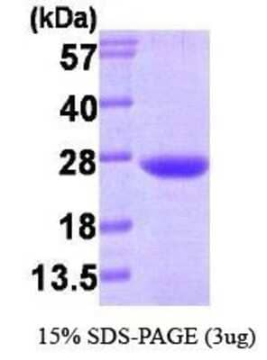 SDS-Page: VPS28 Protein [NBP1-30248] - VPS28, 25.4 kDa (221aa), confirmed by MALDI-TOF with a purity of 95% by SDS - PAGE