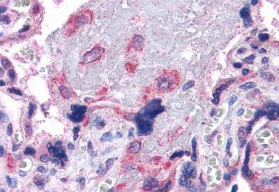 Immunohistochemistry-Paraffin: VPS29 Antibody [NB100-41109] - Staining of paraffin embedded Human Placenta. Antibody at 3.75 ug/mL. Steamed antigen retrieval with citrate buffer pH 6, AP-staining.