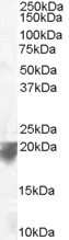 Western Blot: VPS29 Antibody [NB100-1387] - (0.1ug/ml) of Human Spleen lysate (RIPA buffer, 35ug total protein per lane). Primary incubated for 1 hour. Detected by western blot using chemiluminescence.