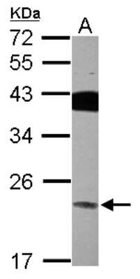 Western Blot: VPS29 Antibody [NBP2-20871] - Sample (30 ug of whole cell lysate) A: HepG2 12% SDS PAGE gel, diluted at 1:2000.