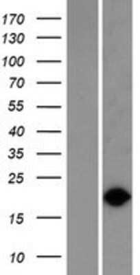 Western Blot: VPS29 Overexpression Lysate (Adult Normal) [NBP2-05800] Left-Empty vector transfected control cell lysate (HEK293 cell lysate); Right -Over-expression Lysate for VPS29.