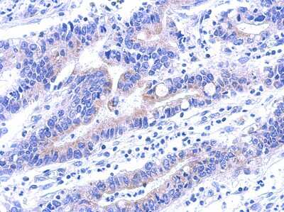 Immunohistochemistry-Paraffin VPS33A Antibody