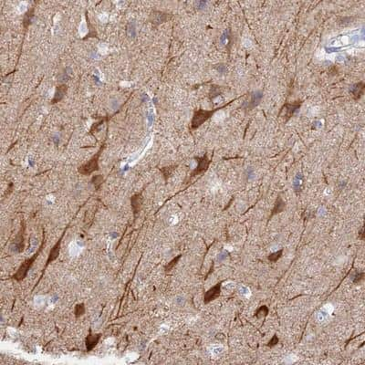 Immunohistochemistry-Paraffin: VPS33B Antibody [NBP1-82220] - Staining of human cerebral cortex shows strong cytoplasmic positivity in neuronal cells.