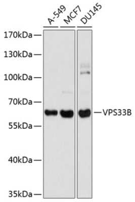 Western Blot VPS33B Antibody - BSA Free