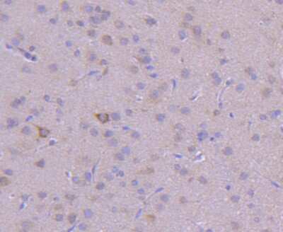 Immunohistochemistry-Paraffin: VPS34 Antibody (SY0286) [NBP2-67450] - Analysis of paraffin-embedded rat brain tissue using anti-PI 3 Kinase Class 3 antibody. Counter stained with hematoxylin.
