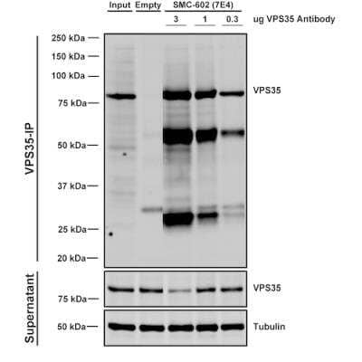 Immunoprecipitation: VPS35 Antibody (7E4) [NBP2-78823] - Tissue: embryonic fibroblast. Species: Mouse. Primary Antibody: Mouse Anti-VPS35 Monoclonal Antibody (NBP2-78823). Three amounts of NBP2-78823 (3, 1 and 0.3 ug) were non-covalently coupled to 10uL of A/G sepharose beads for 1 hour at 4 degrees C and next incubated with 250ug of MEF lysate for 2 hours at 4 degrees C.