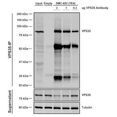 Immunoprecipitation: VPS35 Antibody (7E4) [NBP2-78823] - Immunoprecipitation analysis using Mouse Anti-VPS35 Monoclonal Antibody, Clone 7E4. Tissue: A549 cells. Species: Human. Primary Antibody: Mouse Anti-VPS35 Monoclonal Antibody. Three amounts of NBP2-78823 (3, 1 and 0.3 ug) were non-covalently coupled to 10uL of A/G sepharose beads for 1 hour at 4C and next incubated with 250ug of A549 lysate for 2 hours at 4C.