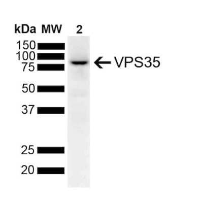 Western Blot: VPS35 Antibody (7E4) [NBP2-78823] - Western Blot analysis of Human SH-SY5Y lysates showing detection of 91.7 kDa VPS35 protein using Mouse Anti-VPS35 Monoclonal Antibody, Clone 7E4 (NBP2-78823). Lane 1: Molecular Weight Ladder. Lane 2: SH-SY5Y. Load: 10 ug. Block: 5% Skim Milk powder in TBST. Primary Antibody: Mouse Anti-VPS35 Monoclonal Antibody (NBP2-78823) at 1:1000 for 2 hours at RT with shaking. Secondary Antibody: Goat anti-mouse IgG:HRP at 1:4000 for 1 hour at RT with shaking. Color Development: Chemiluminescent for HRP (Moss) for 5 min in RT. Predicted/Observed Size: 91.7 kDa.