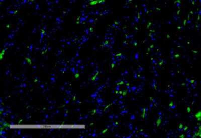 Immunohistochemistry: VPS35 Antibody (8A3) [NBP2-78825] - Immunohistochemistry analysis using Mouse Anti-VPS35 Monoclonal Antibody, Clone 8A3 (NBP2-78825). Tissue: Kidney. Species: Mouse. Primary Antibody: Mouse Anti-VPS35 Monoclonal Antibody (NBP2-78825) at 1:100 for Overnight at 4C, then 30 min at 37C. Secondary Antibody: Goat Anti-Mouse IgG (H+L): FITC for 45 min at 37C. Counterstain: DAPI for 3 min at RT. Magnification: 20X.