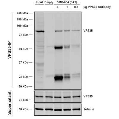 Immunoprecipitation: VPS35 Antibody (8A3) [NBP2-78825] - Immunoprecipitation analysis using Mouse Anti-VPS35 Monoclonal Antibody, Clone 8A3. Tissue: A549 cells. Species: Human. Primary Antibody: Mouse Anti-VPS35 Monoclonal Antibody. Three amounts of NBP2-78825 (3, 1 and 0.3 ug) were non-covalently coupled to 10uL of A/G sepharose beads for 1 hour at 4C and next incubated with 250ug of A549 lysate for 2 hours at 4C.