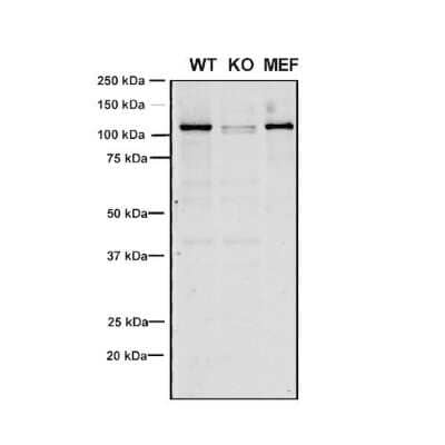 Western Blot: VPS35 Antibody (8A3) [NBP2-78825] - Western Blot analysis of Human, Mouse A549, MEF showing detection of VPS35 protein using Mouse Anti-VPS35 Monoclonal Antibody, Clone 8A3 (NBP2-78825). Lane 1: Molecular Weight Ladder. Lane 2: VPS35 KO A549 cells. Lane 3: mouse embryonic fibroblast cells.. Load: 8 ug each A549 and MEF. Primary Antibody: Mouse Anti-VPS35 Monoclonal Antibody (NBP2-78825) at 1:5 (tissue culture supernatant). Secondary Antibody: Donkey anti-mouse IRDye 800CW at 1:25000 in TBS-T.