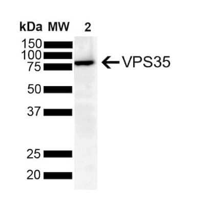 Western Blot: VPS35 Antibody (8A3) [NBP2-78825] - Western Blot analysis of Human SH-SY5Y showing detection of VPS35 protein using Mouse Anti-VPS35 Monoclonal Antibody, Clone 8A3 (NBP2-78825). Lane 1: Molecular Weight Ladder. Lane 2: SH-SY5Y (10 ug). Load: 10 ug. Block: 5% Skim Milk powder in TBST. Primary Antibody: Mouse Anti-VPS35 Monoclonal Antibody (NBP2-78825) at 1:1000 for 2 hours at RT with shaking. Secondary Antibody: Goat anti-mouse IgG:HRP at 1:4000 for 1 hour at RT with shaking. Color Development: Chemiluminescent for HRP (Moss) for 5 min in RT.