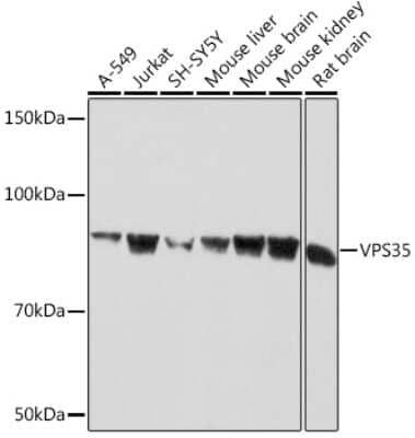 Western Blot: VPS35 Antibody (8D3L3) [NBP3-16803] - Western blot analysis of extracts of various cell lines, using VPS35 Rabbit mAb (NBP3-16803) at 1:1000 dilution. Secondary antibody: HRP Goat Anti-Rabbit IgG (H+L) at 1:10000 dilution. Lysates/proteins: 25ug per lane. Blocking buffer: 3% nonfat dry milk in TBST. Detection: ECL Basic Kit. Exposure time: 30s.