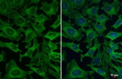 <b>Genetic Strategies Validation. </b>Immunocytochemistry/Immunofluorescence: VPS35 Antibody (HL1017) [NBP3-13680] - VPS35 antibody detects VPS35 protein at cytoplasm by immunofluorescent analysis. Sample: HeLa cells were fixed in 4% paraformaldehyde at RT for 15 min. Green: VPS35 stained by VPS35 antibody (NBP3-13680) diluted at 1:500.