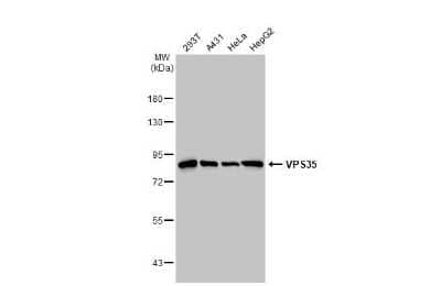 Western Blot: VPS35 Antibody (HL1017) [NBP3-13680] - Various whole cell extracts (30 ug) were separated by 7.5% SDS-PAGE, and the membrane was blotted with VPS35 antibody [HL1017] (NBP3-13680) diluted at 1:1000. The HRP-conjugated anti-rabbit IgG antibody (NBP2-19301) was used to detect the primary antibody.