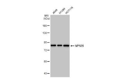 Western Blot: VPS35 Antibody (HL1017) [NBP3-13680] - Various whole cell extracts (30 ug) were separated by 7.5% SDS-PAGE, and the membrane was blotted with VPS35 antibody [HL1017] (NBP3-13680) diluted at 1:1000. The HRP-conjugated anti-rabbit IgG antibody (NBP2-19301) was used to detect the primary antibody.