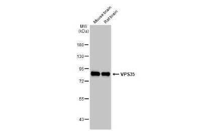 Western Blot: VPS35 Antibody (HL1017) [NBP3-13680] - Various tissue extracts (50 ug) were separated by 7.5% SDS-PAGE, and the membrane was blotted with VPS35 antibody [HL1017] (NBP3-13680) diluted at 1:1000. The HRP-conjugated anti-rabbit IgG antibody (NBP2-19301) was used to detect the primary antibody.