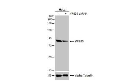 Western Blot: VPS35 Antibody (HL1017) [NBP3-13680] - Non-transfected (-) and transfected (+) HeLa whole cell extracts (30 ug) were separated by 7.5% SDS-PAGE, and the membrane was blotted with VPS35 antibody [HL1017] (NBP3-13680) diluted at 1:1000. The HRP-conjugated anti-rabbit IgG antibody (NBP2-19301) was used to detect the primary antibody.