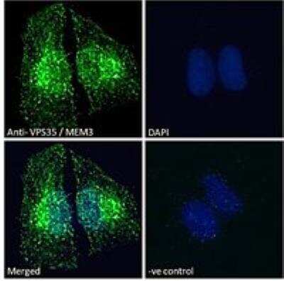 Immunocytochemistry/Immunofluorescence: VPS35 Antibody [NB100-1397] - Immunofluorescence analysis of paraformaldehyde fixed HEK293 cells, permeabilized with 0.15% Triton. Primary incubation 1hr (10ug/ml) followed by Alexa Fluor 488 secondary antibody (2ug/ml), showing cytoplasmic/vesicle staining. The nuclear stain is DAPI (blue). Negative control: Unimmunized goat IgG (10ug/ml) followed by Alexa Fluor 488 secondary antibody (2ug/ml).