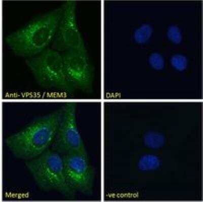 Immunocytochemistry/Immunofluorescence: VPS35 Antibody [NB100-1397] - Immunofluorescence analysis of paraformaldehyde fixed U2OS cells, permeabilized with 0.15% Triton. Primary incubation 1hr (10ug/ml) followed by Alexa Fluor 488 secondary antibody (2ug/ml), showing cytoplasmic/vesicle staining. The nuclear stain is DAPI (blue). Negative control: Unimmunized goat IgG (10ug/ml) followed by Alexa Fluor 488 secondary antibody (2ug/ml).