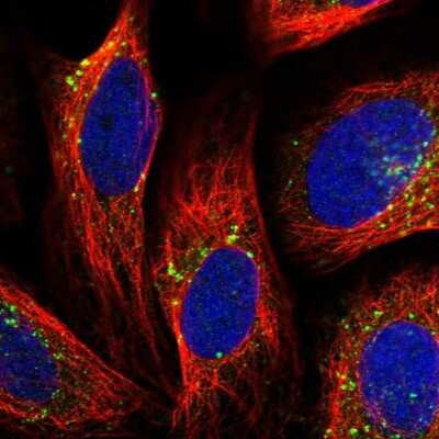 <b>Genetic Strategies Validation. </b>Immunocytochemistry/Immunofluorescence: VPS35 Antibody [NBP2-13517] - Staining of human cell line U-2 OS shows localization to endosomes & lysosomes. Antibody staining is shown in green.