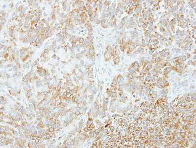 Immunohistochemistry-Paraffin: VPS35 Antibody [NBP2-20876] - A549 xenograft, using antibody at 1:500 dilution. Antigen Retrieval: TrilogyTM (EDTA based) buffer, 15min