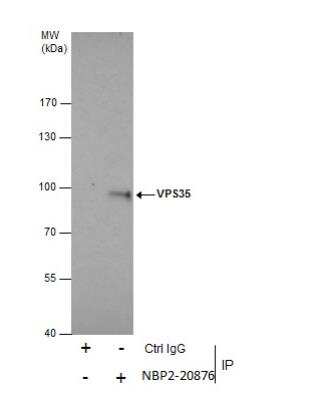 Immunoprecipitation: VPS35 Antibody [NBP2-20876] - Immunoprecipitation of VPS35 protein from HeLa whole cell extracts using 5 ug of VPS35 antibody.  Western blot analysis was performed using VPS35 antibody.  EasyBlot anti-Rabbit IgG was used as a secondary reagent.