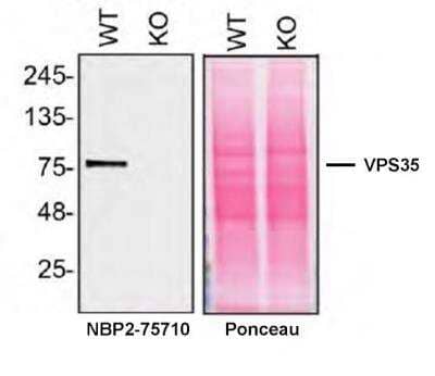 Knockout Validated: VPS35 Antibody (JB33-82) [NBP2-75710] - Lysates of HAP1 WT and VPS35 KO were prepared, and 20 ug of protein were processed for immunoblot with the VPS35 antibody (JB33-82). The Ponceau stained transfer of the blot is shown. Antibody dilution used: NBP2-75710 at 1/1000. Predicted band size: 91 kDa. Image, protocol and testing courtesy of YCharOS Inc. (ycharos.com).