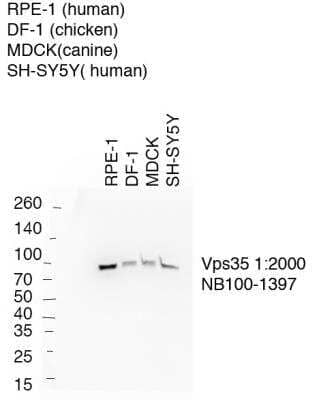 Western Blot: VPS35 Antibody [NB100-1397] - 10 ug cell lysate per lane of various cell lines as indicated, immunoblotted with vps35 antibody at 1:2000 at 4C for 20 hrs. Secondary antibody donkey anti-goat HRP at 1:5000 for 1 hr at room temp. WB image submitted by a verified customer review.