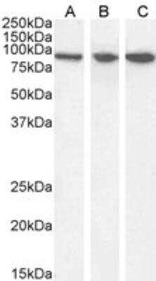 Western Blot: VPS35 Antibody [NB100-1397] - Staining of Human (A) Mouse (B) and Rat (C) Brain lysate (35 ug protein in RIPA buffer). antibody at 0.03 ug/mL. Detected by chemiluminescence.